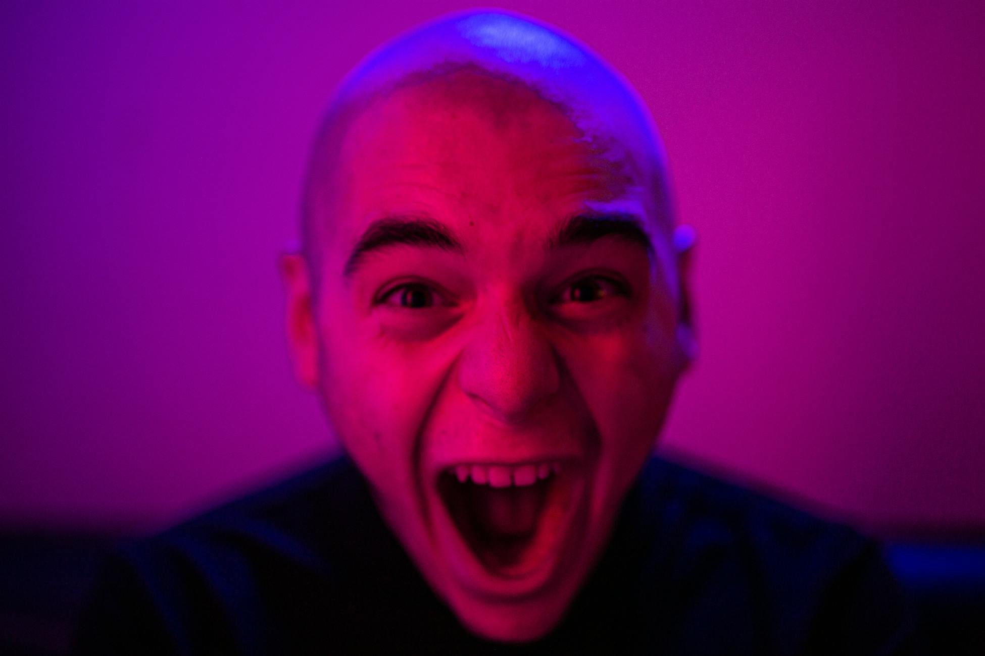 Øjenlågsoperation (blefaroplastik) behandling i Odder - find klinik